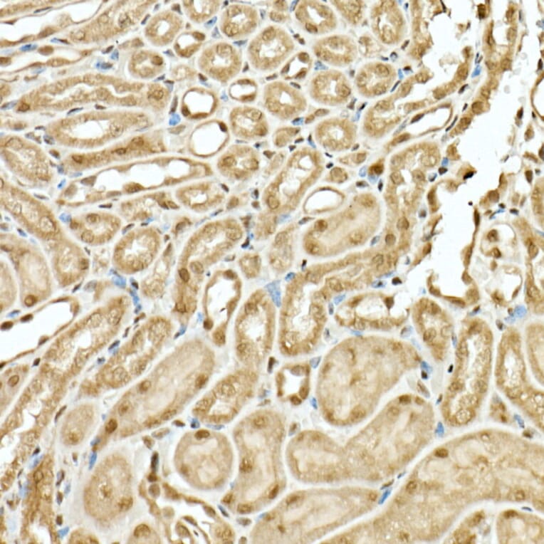 Immunohistochemistry - Anti-VIRMA/KIAA1429 Antibody (A88666) - Antibodies.com