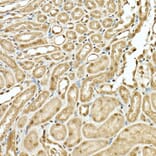 Immunohistochemistry - Anti-VIRMA/KIAA1429 Antibody (A88666) - Antibodies.com