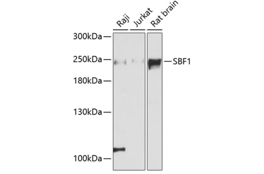 Western Blot - Anti-Sbf1 Antibody (A88667) - Antibodies.com