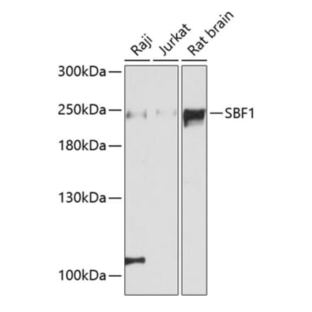 Western Blot - Anti-Sbf1 Antibody (A88667) - Antibodies.com