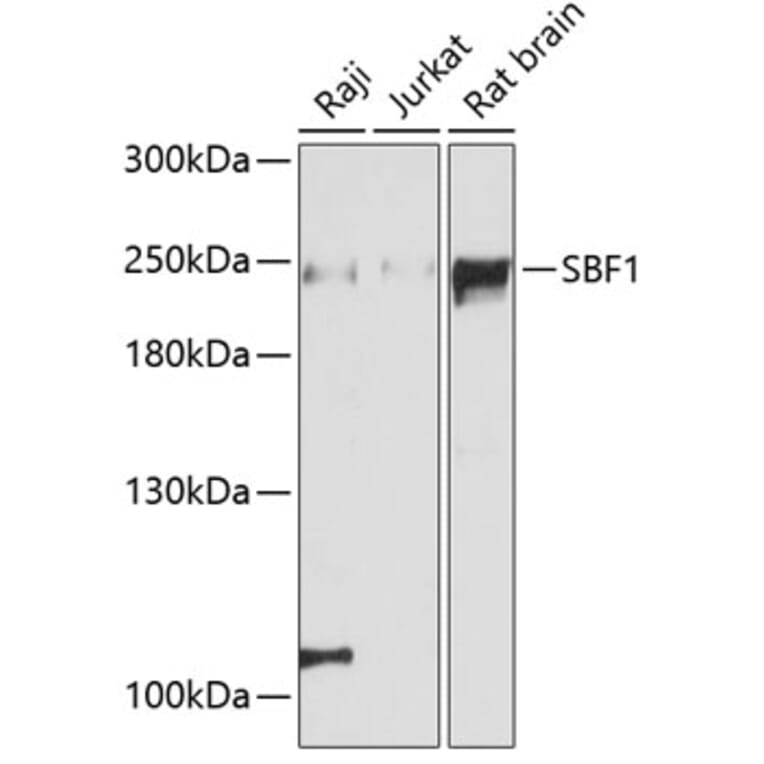 Western Blot - Anti-Sbf1 Antibody (A88667) - Antibodies.com