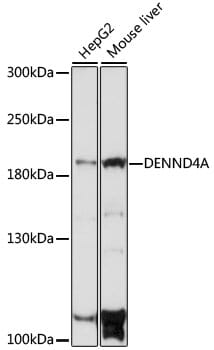 Western blot analysis of extracts of various cell lines, using Anti-DENND4A Antibody (A16095) at 1:1,000 dilution.
Secondary antibody: Goat Anti-Rabbit IgG (H+L) (HRP) (AS014) at 1:10,000 dilution.
Lysates / proteins: 25µg per lane.
Blocking buffer: 3% non-fat dry milk in TBST.
Detection: ECL Basic Kit (RM00020).
Exposure time: 30s.