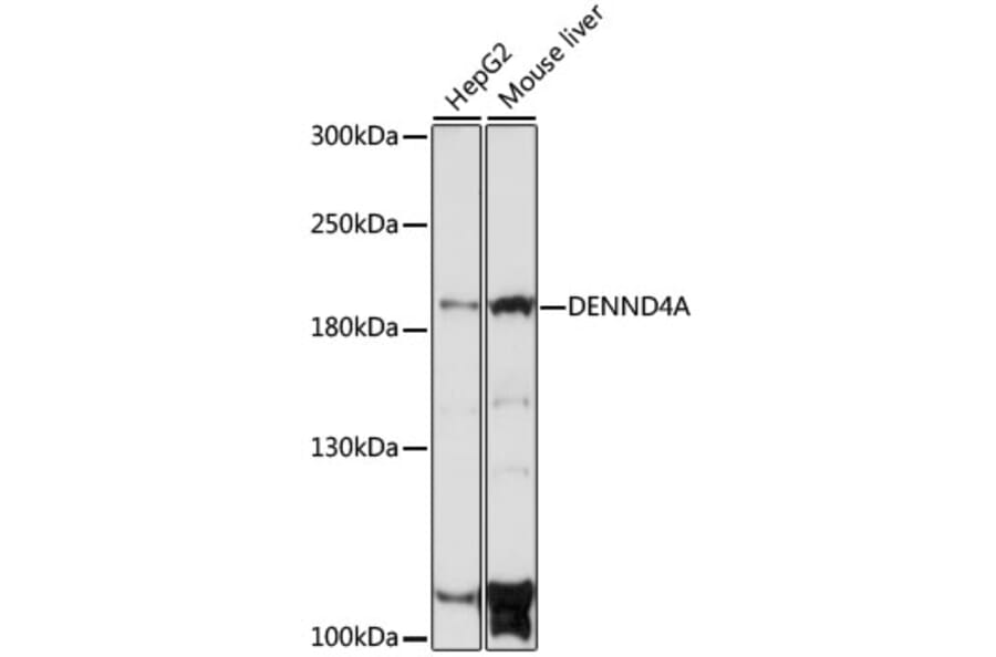 Western Blot - Anti-DENND4A Antibody (A88668) - Antibodies.com