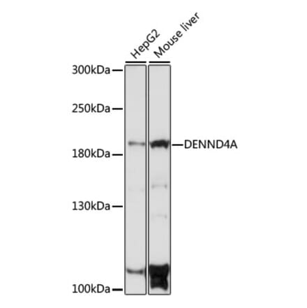 Western Blot - Anti-DENND4A Antibody (A88668) - Antibodies.com