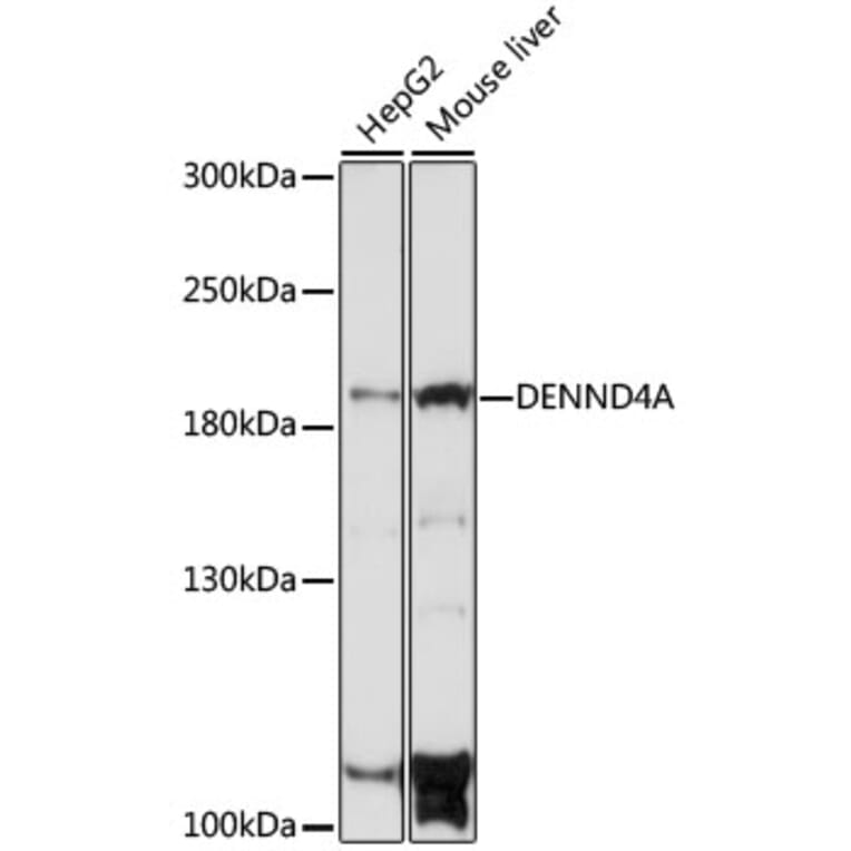 Western Blot - Anti-DENND4A Antibody (A88668) - Antibodies.com