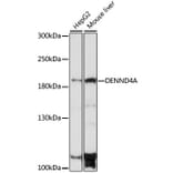 Western Blot - Anti-DENND4A Antibody (A88668) - Antibodies.com