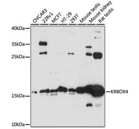 Western Blot - Anti-KRBOX4 Antibody (A88669) - Antibodies.com