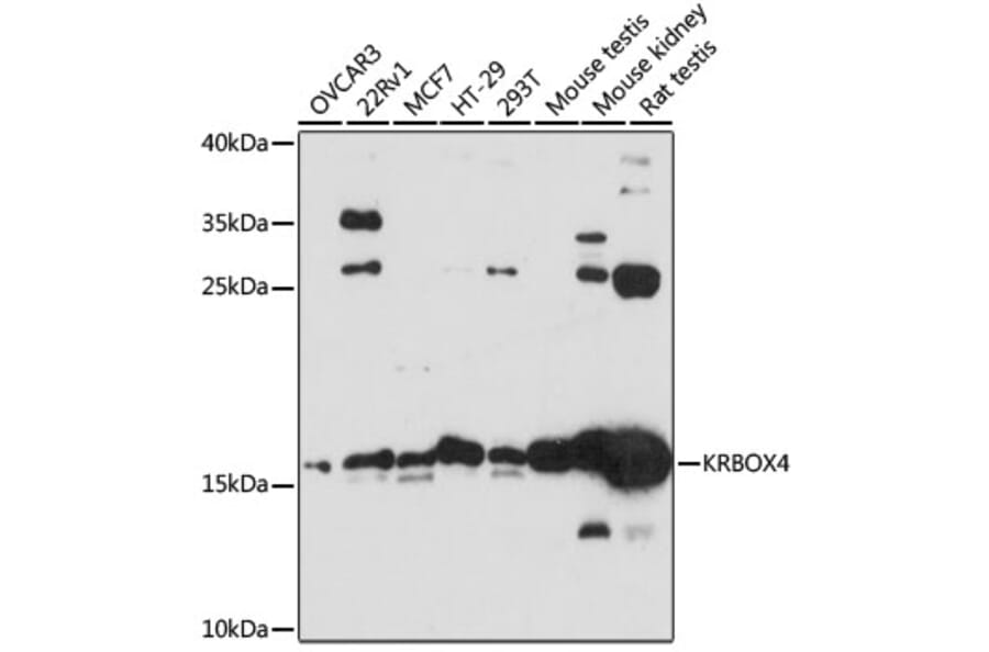 Western Blot - Anti-KRBOX4 Antibody (A88669) - Antibodies.com