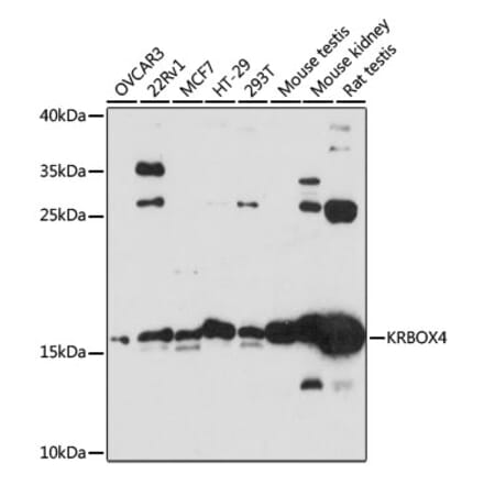 Western Blot - Anti-KRBOX4 Antibody (A88669) - Antibodies.com