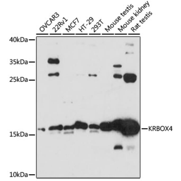 Western Blot - Anti-KRBOX4 Antibody (A88669) - Antibodies.com
