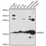 Western Blot - Anti-KRBOX4 Antibody (A88669) - Antibodies.com