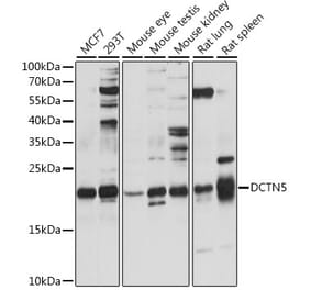 Western Blot - Anti-DCTN5 Antibody (A88670) - Antibodies.com