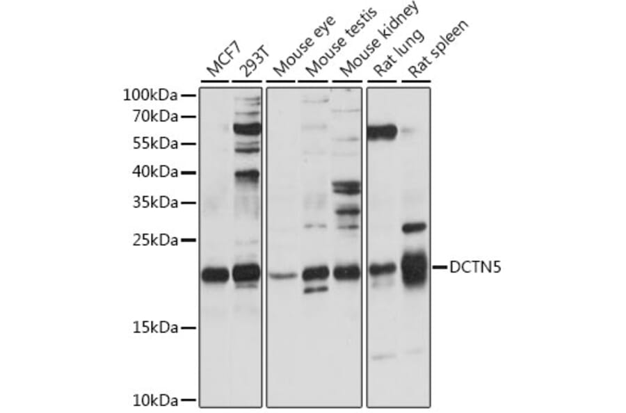 Western Blot - Anti-DCTN5 Antibody (A88670) - Antibodies.com