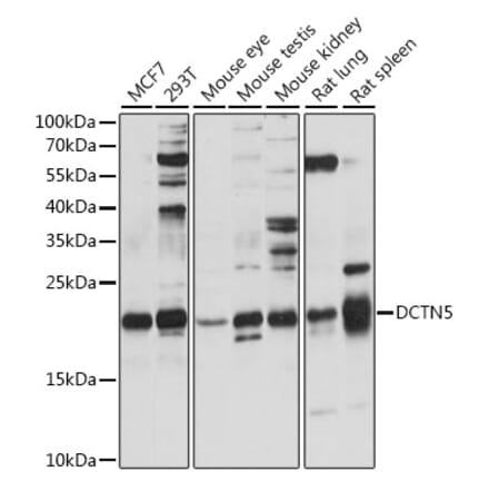 Western Blot - Anti-DCTN5 Antibody (A88670) - Antibodies.com