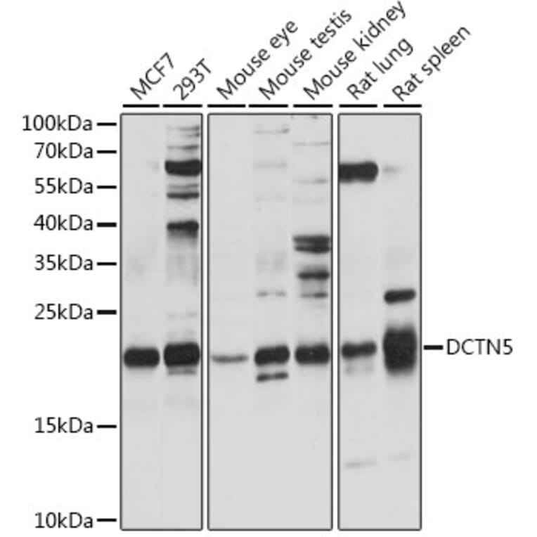 Western Blot - Anti-DCTN5 Antibody (A88670) - Antibodies.com