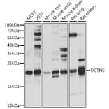 Western Blot - Anti-DCTN5 Antibody (A88670) - Antibodies.com