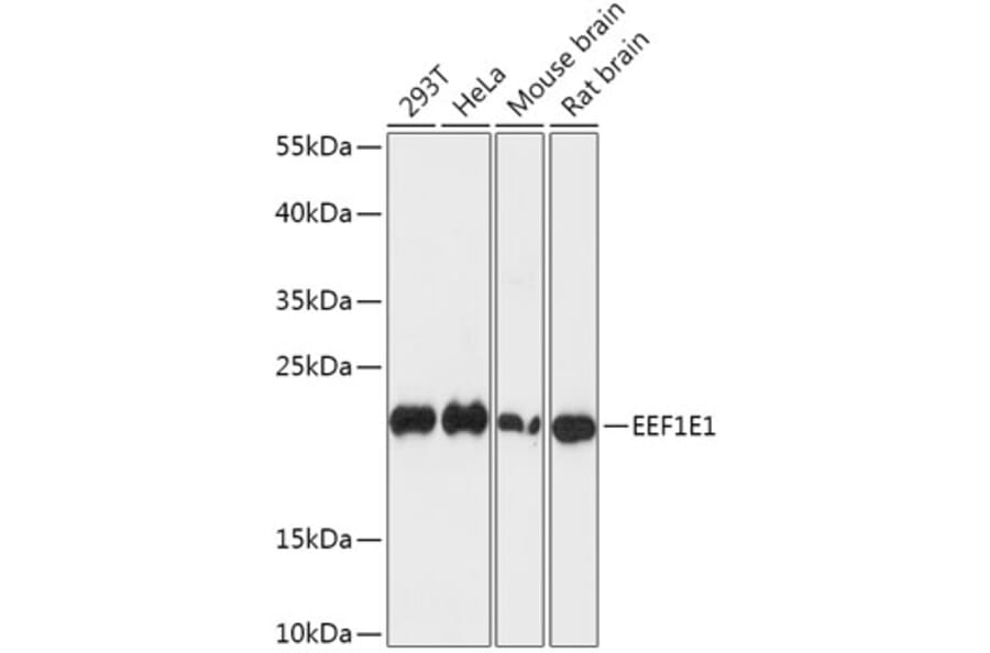 Western Blot - Anti-AIMP3/p18 Antibody (A88671) - Antibodies.com