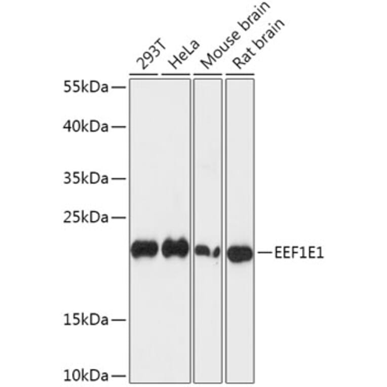 Western Blot - Anti-AIMP3/p18 Antibody (A88671) - Antibodies.com