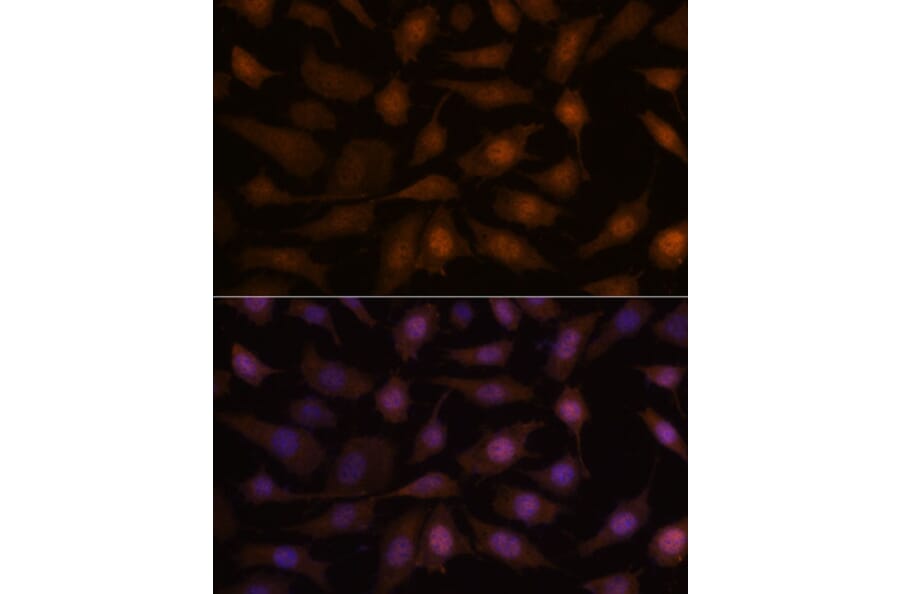 Immunofluorescence - Anti-AIMP3/p18 Antibody (A88671) - Antibodies.com