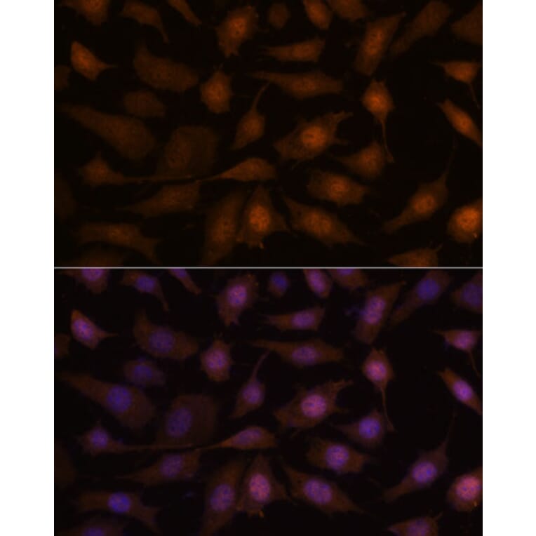 Immunofluorescence - Anti-AIMP3/p18 Antibody (A88671) - Antibodies.com