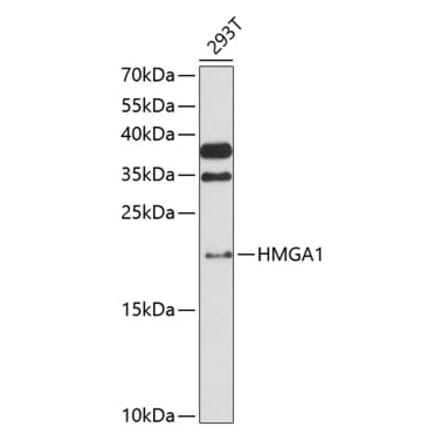 Western Blot - Anti-HMGA1 Antibody (A88672) - Antibodies.com
