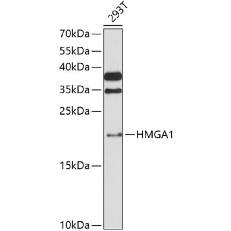 Western Blot - Anti-HMGA1 Antibody (A88672) - Antibodies.com