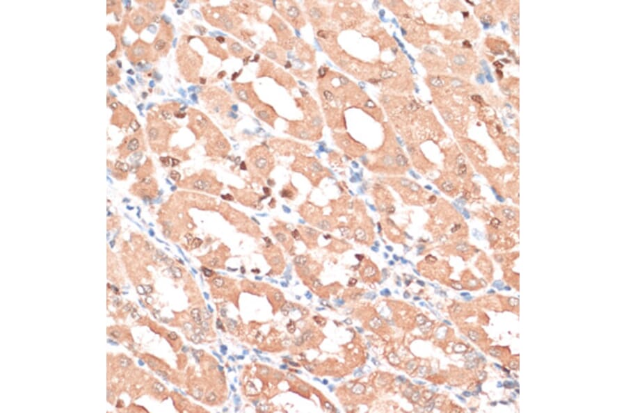 Immunohistochemistry - Anti-HMGA1 Antibody (A88672) - Antibodies.com