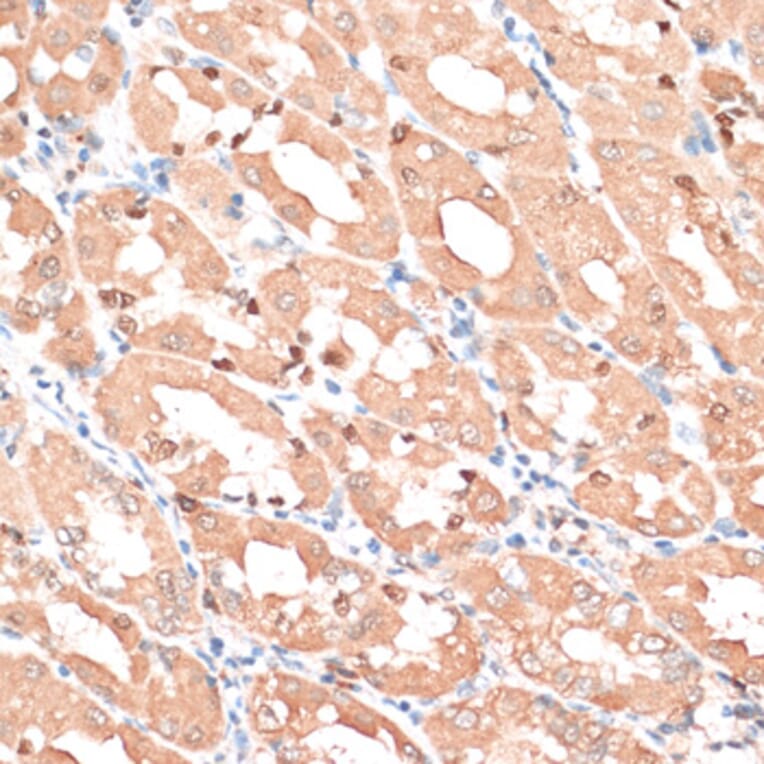 Immunohistochemistry - Anti-HMGA1 Antibody (A88672) - Antibodies.com