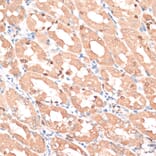 Immunohistochemistry - Anti-HMGA1 Antibody (A88672) - Antibodies.com