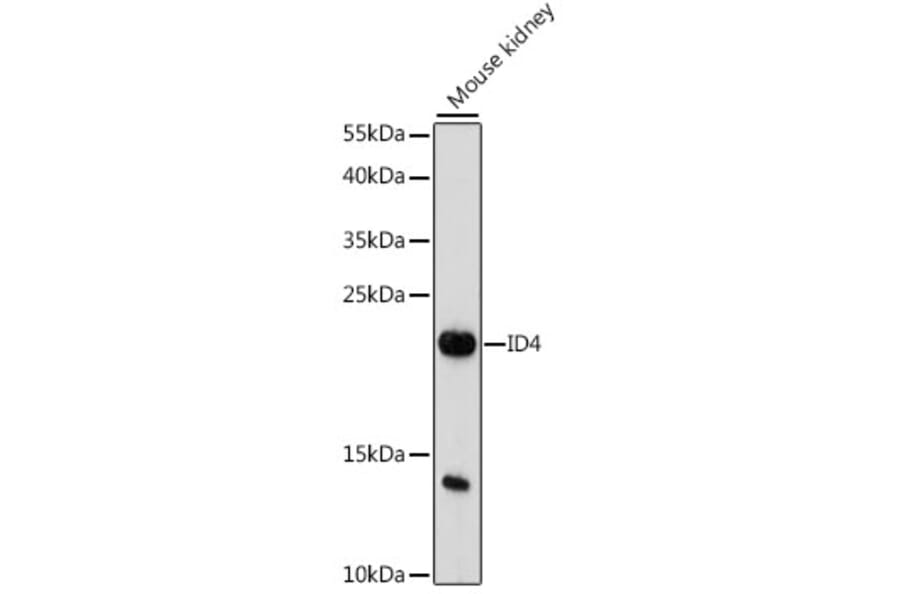 Western Blot - Anti-ID4 Antibody (A88673) - Antibodies.com