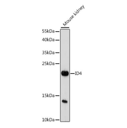 Western Blot - Anti-ID4 Antibody (A88673) - Antibodies.com