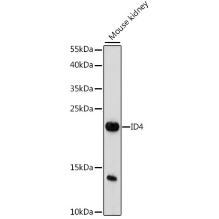 Western Blot - Anti-ID4 Antibody (A88673) - Antibodies.com