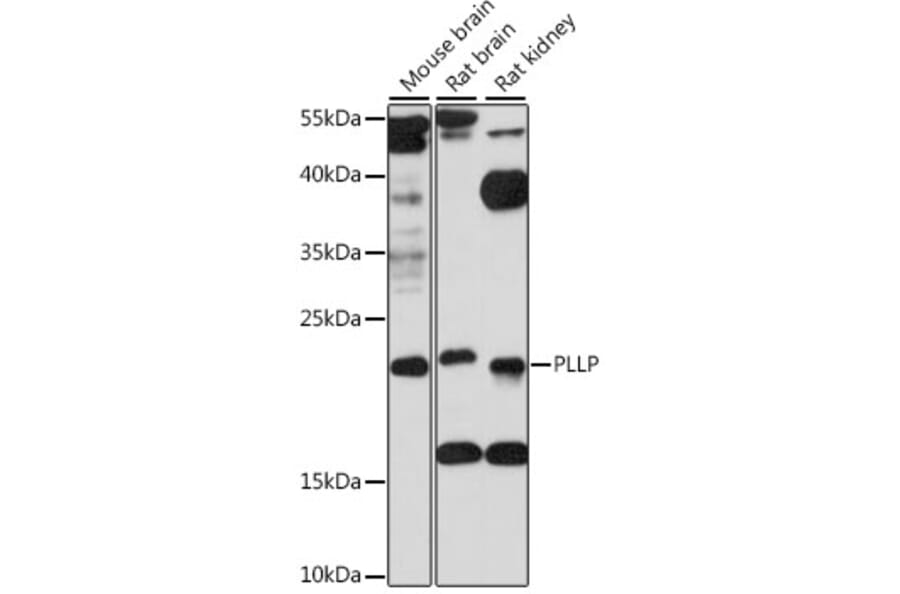 Western Blot - Anti-PLLP Antibody (A88674) - Antibodies.com