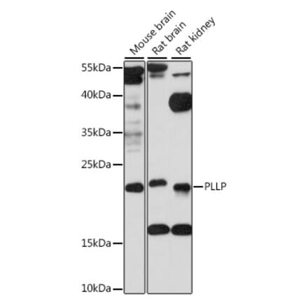 Western Blot - Anti-PLLP Antibody (A88674) - Antibodies.com
