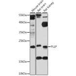 Western Blot - Anti-PLLP Antibody (A88674) - Antibodies.com