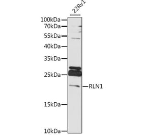 Western Blot - Anti-Relaxin 1 Antibody (A88675) - Antibodies.com