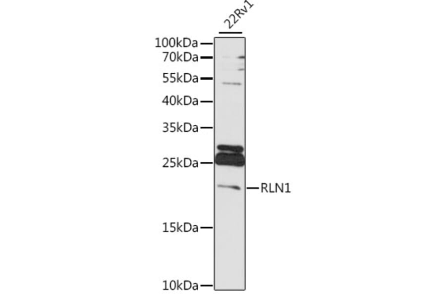 Western Blot - Anti-Relaxin 1 Antibody (A88675) - Antibodies.com