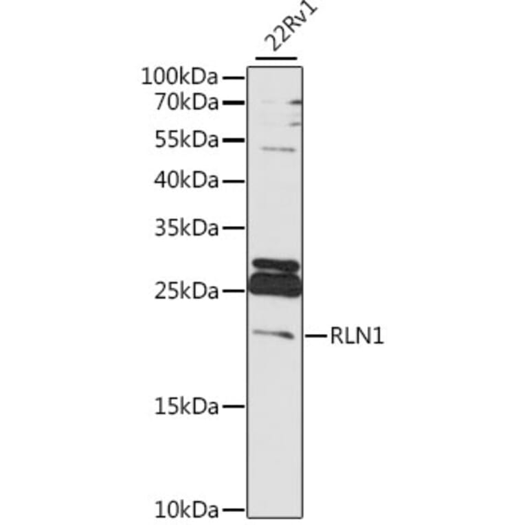 Western Blot - Anti-Relaxin 1 Antibody (A88675) - Antibodies.com