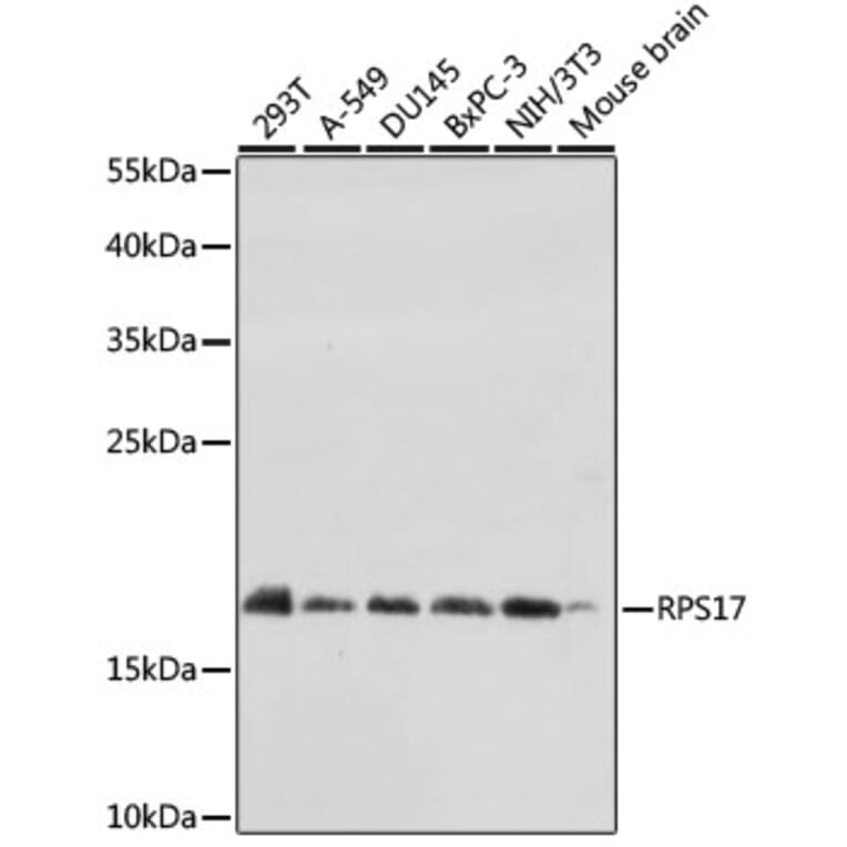 Western Blot - Anti-RPS17 Antibody (A88676) - Antibodies.com
