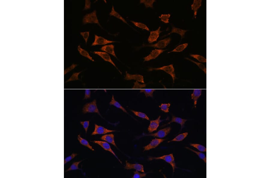 Immunofluorescence - Anti-RPS17 Antibody (A88676) - Antibodies.com