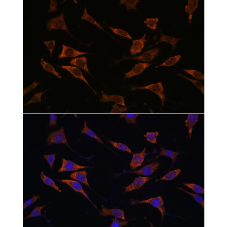 Immunofluorescence - Anti-RPS17 Antibody (A88676) - Antibodies.com