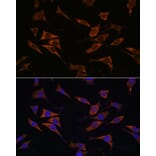 Immunofluorescence - Anti-RPS17 Antibody (A88676) - Antibodies.com