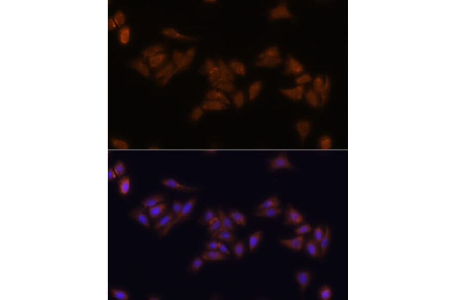 Immunofluorescence - Anti-RPS17 Antibody (A88676) - Antibodies.com