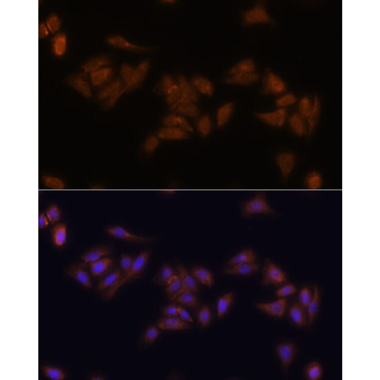 Immunofluorescence - Anti-RPS17 Antibody (A88676) - Antibodies.com