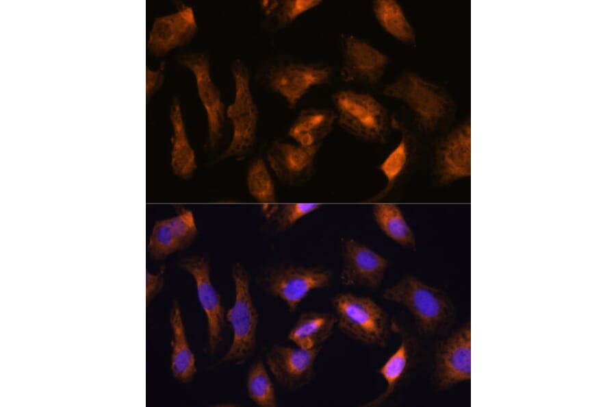 Immunofluorescence - Anti-RPS17 Antibody (A88676) - Antibodies.com