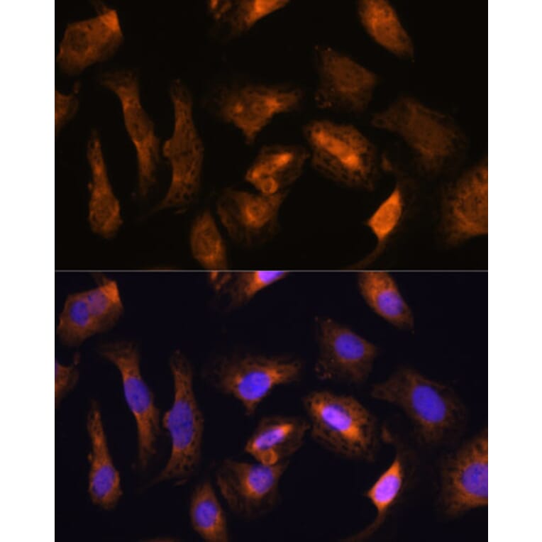 Immunofluorescence - Anti-RPS17 Antibody (A88676) - Antibodies.com
