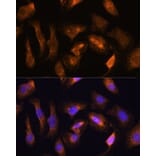 Immunofluorescence - Anti-RPS17 Antibody (A88676) - Antibodies.com