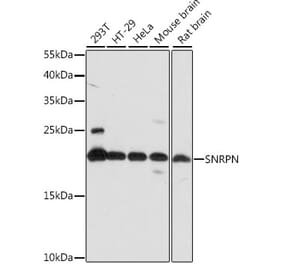 Western Blot - Anti-SNRPN Antibody (A88678) - Antibodies.com