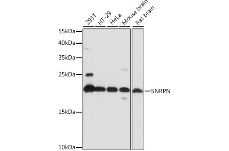 Western Blot - Anti-SNRPN Antibody (A88678) - Antibodies.com