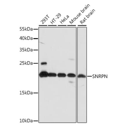 Western Blot - Anti-SNRPN Antibody (A88678) - Antibodies.com